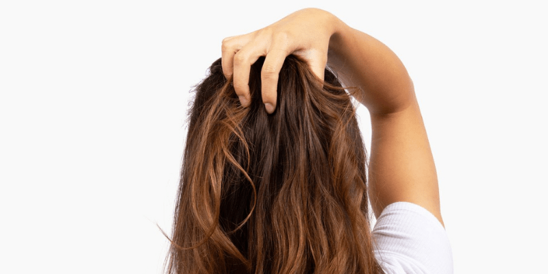 Itchy, Flaky, or Irritated Scalp? Here's What's Going On (and What Helps)