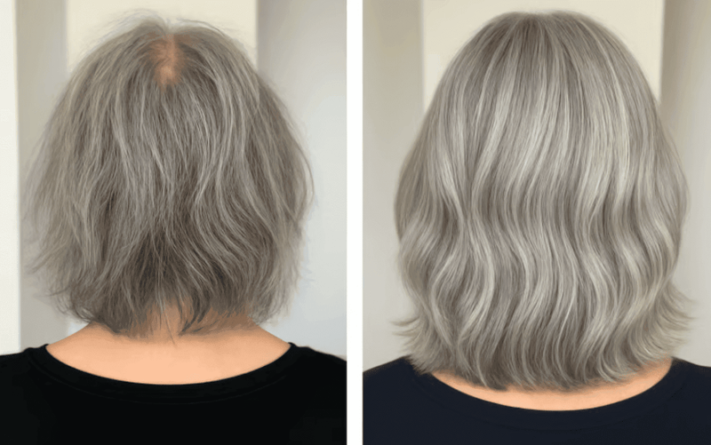 The Root Causes of Hair Thinning: What Science Reveals About Your Scalp