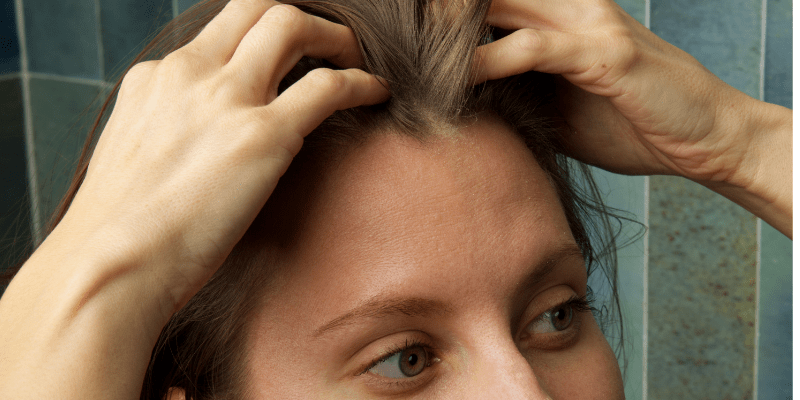 Why Is My Hair So Dry in Winter? How Cold Weather Impacts Hair Health